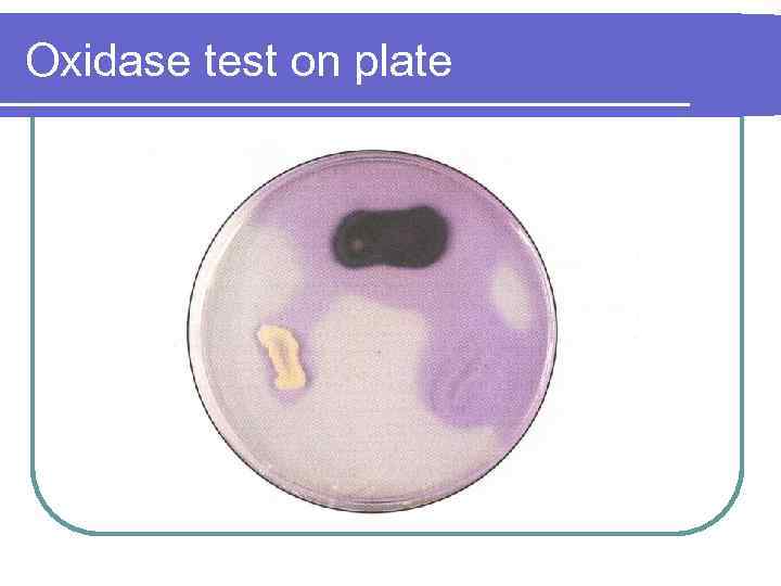 Oxidase test on plate 