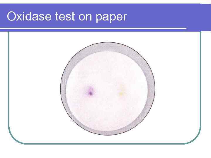 Oxidase test on paper 