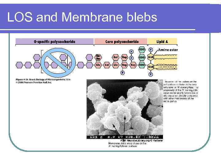 LOS and Membrane blebs 
