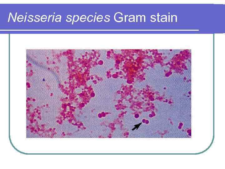 Neisseria species Gram stain 