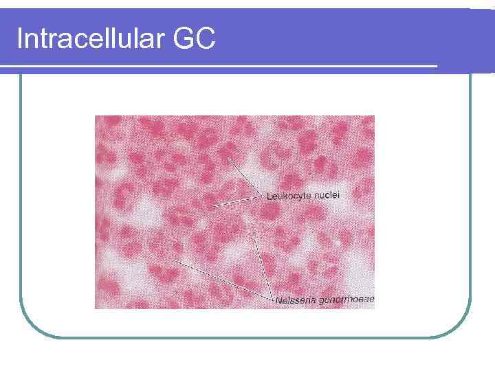 Intracellular GC 