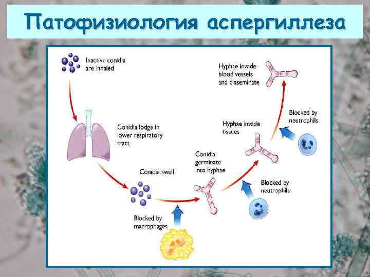 Патофизиология аспергиллеза 