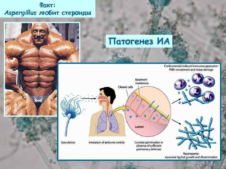 Факт: Aspergillus любит стероиды Патогенез ИА 