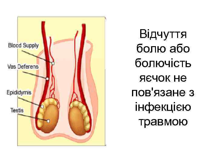 Відчуття болю або болючість яєчок не пов'язане з інфекцією травмою 