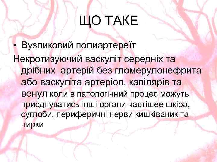 ЩО ТАКЕ • Вузликовий полиартереїт Некротизуючий васкуліт середніх та дрібних артерій без гломерулонефрита або