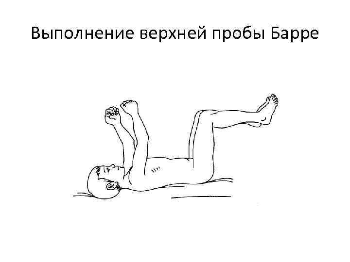 Выполнение верхней пробы Барре 