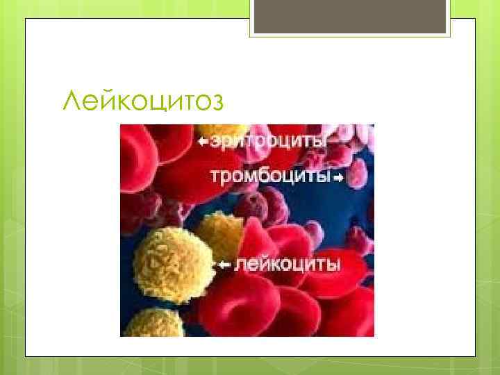 Лейкоцитоз 