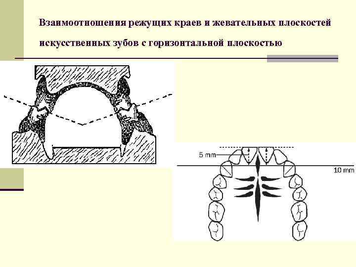 Взаимоотношения режущих краев и жевательных плоскостей искусственных зубов с горизонтальной плоскостью 