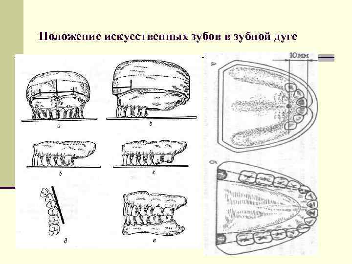 Искусственные зубы презентация