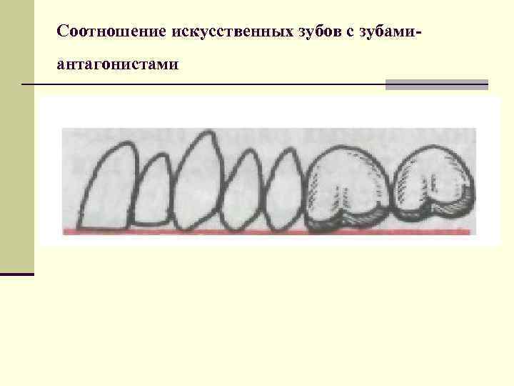 Соотношение искусственных зубов с зубамиантагонистами 