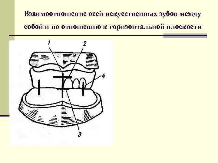 Постановка зубов по стеклу презентация