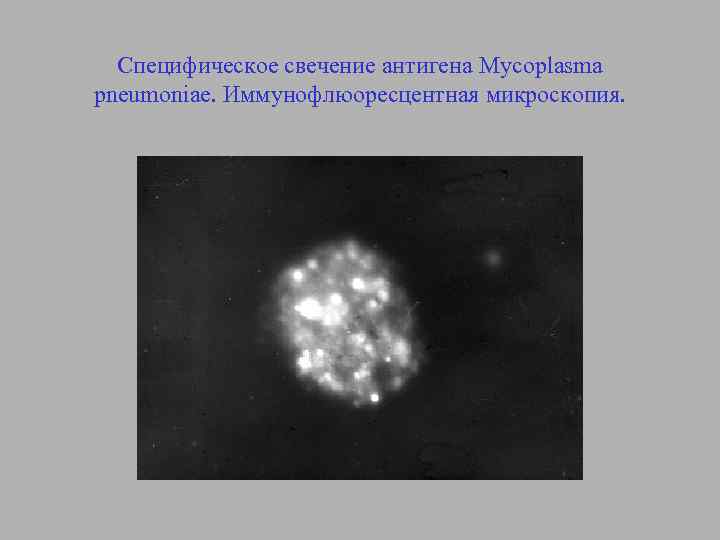 Специфическое свечение антигена Mycoplasma pneumoniae. Иммунофлюоресцентная микроскопия. 