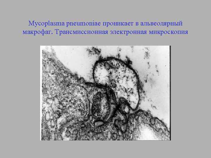 Mycoplasma pneumoniae проникает в альвеолярный макрофаг. Трансмиссионная электронная микроскопия 