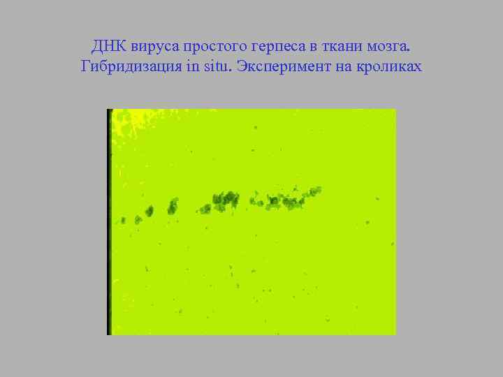 ДНК вируса простого герпеса в ткани мозга. Гибридизация in situ. Эксперимент на кроликах 