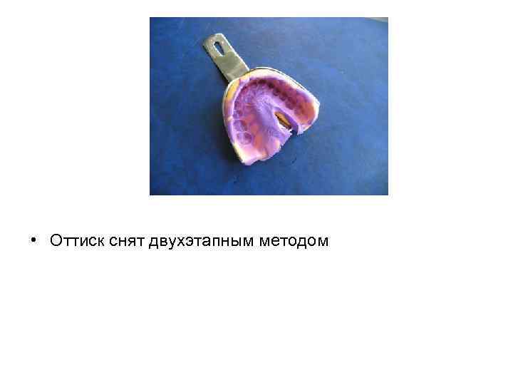  • Оттиск снят двухэтапным методом 