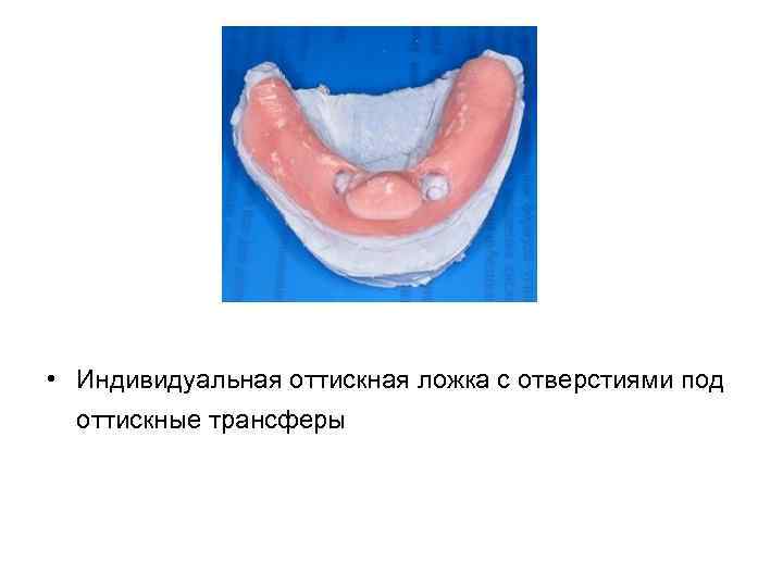 Снятие оттиска индивидуальной ложкой под псп