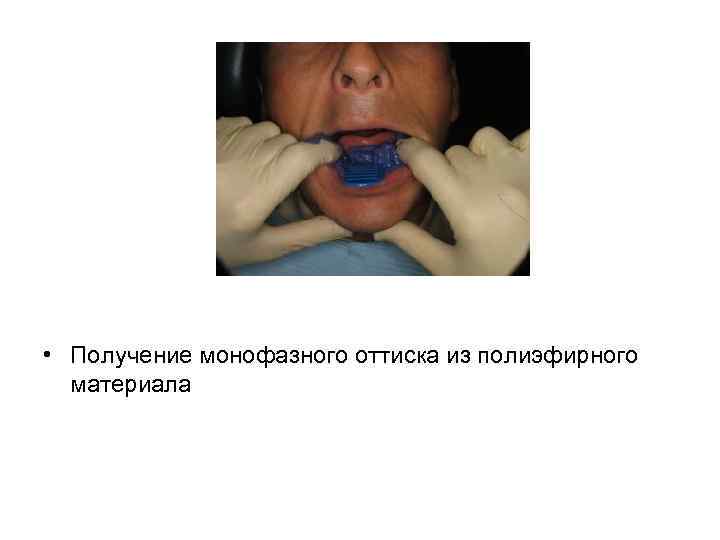 • Получение монофазного оттиска из полиэфирного материала 