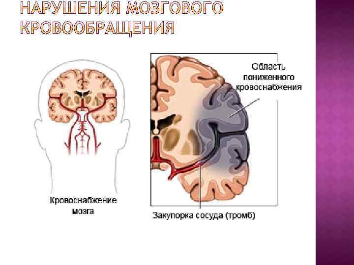 Причины сенсорно моторной алалии