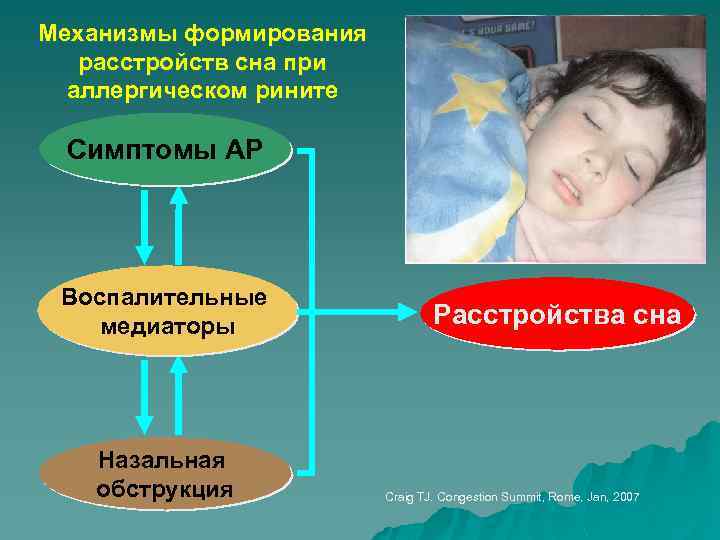 Механизмы формирования расстройств сна при аллергическом рините Симптомы АР Воспалительные медиаторы Назальная обструкция Расстройства