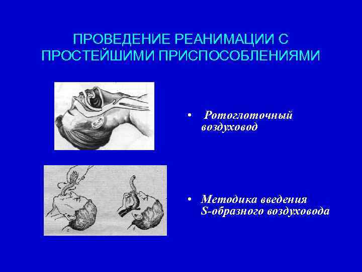 ПРОВЕДЕНИЕ РЕАНИМАЦИИ С ПРОСТЕЙШИМИ ПРИСПОСОБЛЕНИЯМИ • Ротоглоточный воздуховод • Методика введения S образного воздуховода