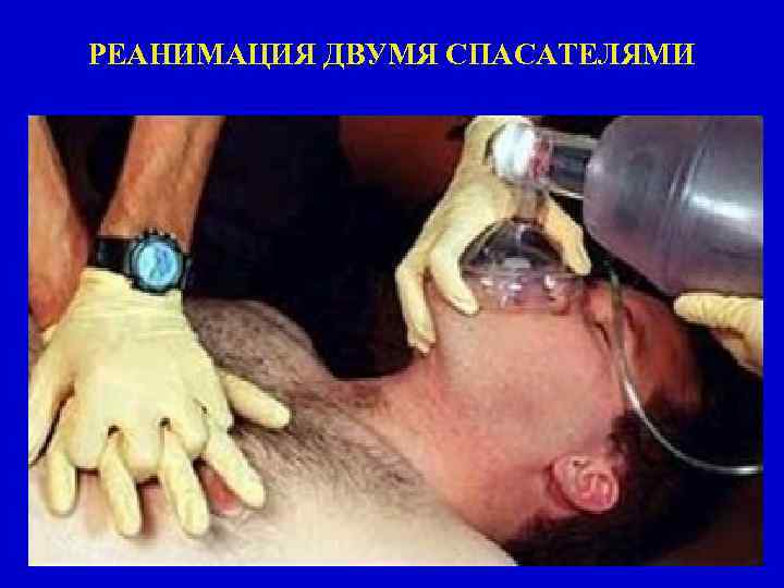 РЕАНИМАЦИЯ ДВУМЯ СПАСАТЕЛЯМИ 