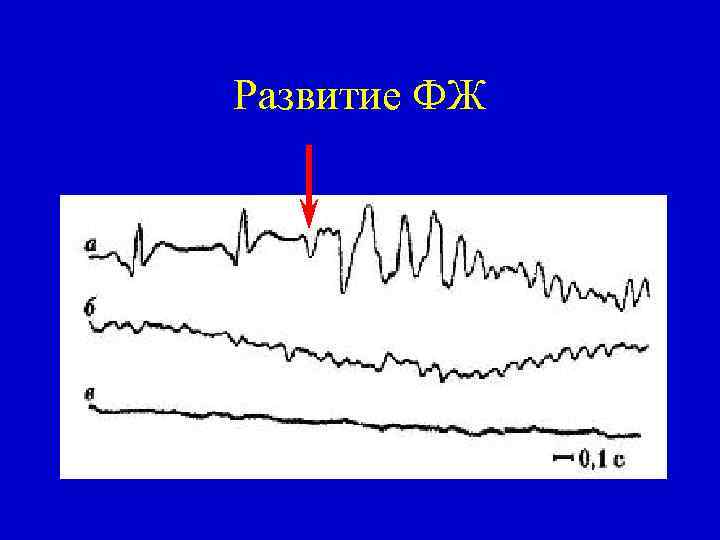 Развитие ФЖ 