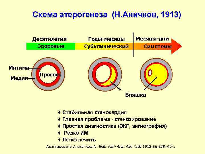 Схема атерогенеза (Н. Аничков, 1913) Десятилетия Здоровые Годы-месяцы Субклинический Месяцы-дни Симптомы Интима Медия Просвет