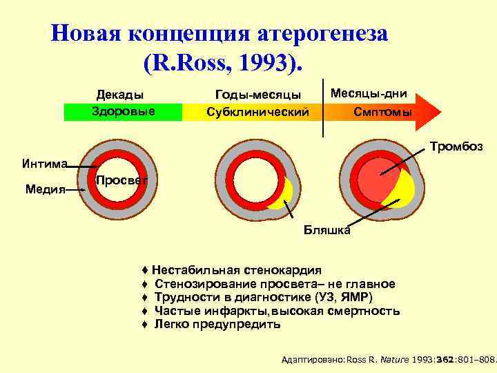 Новая концепция атерогенеза (R. Ross, 1993). Декады Здоровые Годы-месяцы Субклинический Месяцы-дни Смптомы Тромбоз Интима