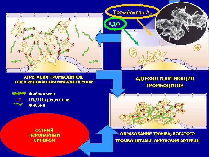 Тромбоксан A 2 АДФ АГРЕГАЦИЯ ТРОМБОЦИТОВ, ОПОСРЕДОВАННАЯ ФИБРИНОГЕНОМ АДГЕЗИЯ И АКТИВАЦИЯ ТРОМБОЦИТОВ Фибриноген IIb/IIIa