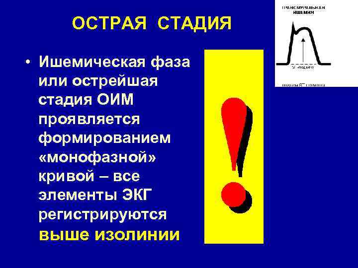 ОСТРАЯ СТАДИЯ • Ишемическая фаза или острейшая стадия ОИМ проявляется формированием «монофазной» кривой –