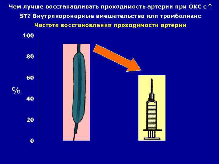 Чем лучше восстанавливать проходимость артерии при ОКС с ST? Внутрикоронарные вмешательства или тромболизис Частота