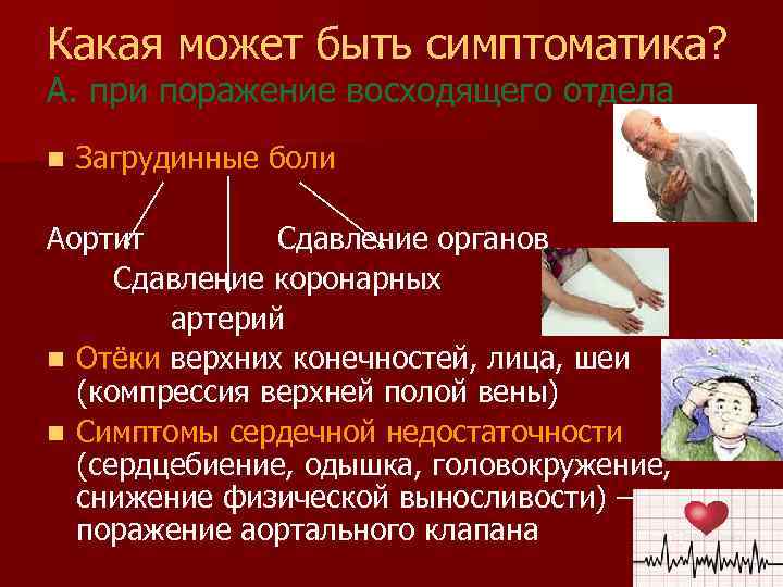 Какая может быть симптоматика? А. при поражение восходящего отдела n Загрудинные боли Аортит Сдавление