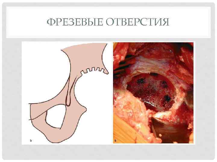 ФРЕЗЕВЫЕ ОТВЕРСТИЯ 