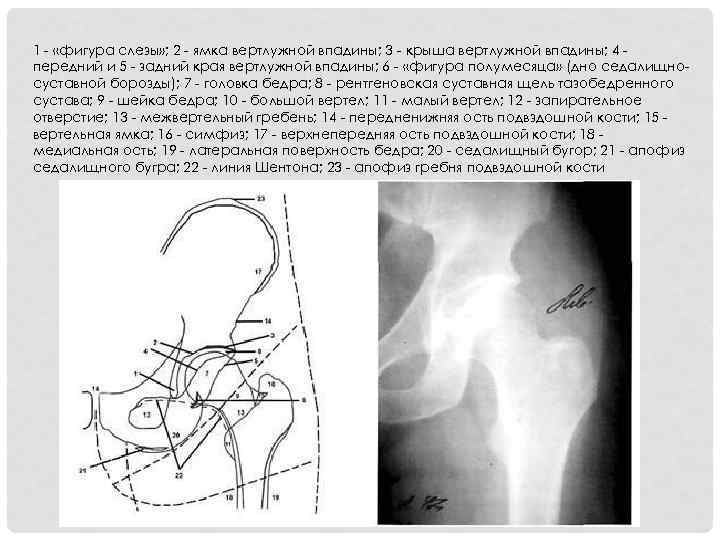 Ушиб тазобедренного сустава карта смп - 97 фото