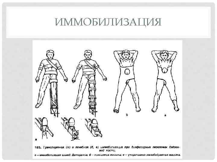 Ушиб тазобедренного сустава карта смп - 97 фото