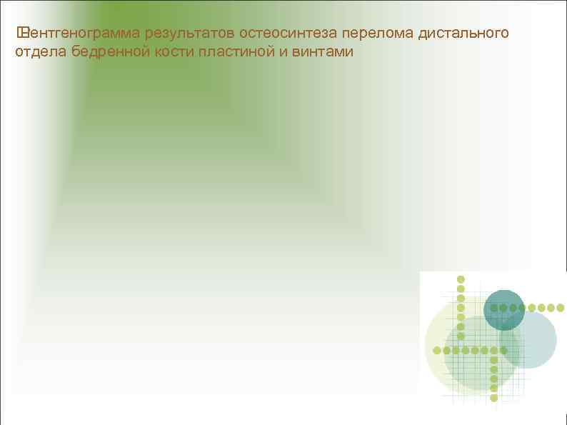  Рентгенограмма результатов остеосинтеза перелома дистального отдела бедренной кости пластиной и винтами 