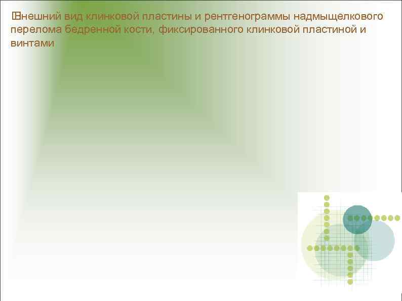  Внешний вид клинковой пластины и рентгенограммы надмыщелкового перелома бедренной кости, фиксированного клинковой пластиной