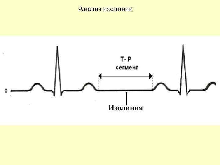 Анализ изолинии 