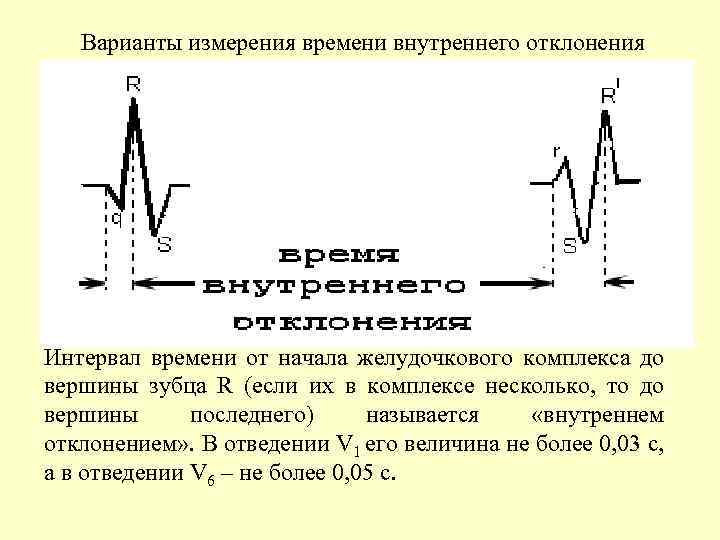 Варианта измерений. Интервал внутреннего отклонения на ЭКГ как определить. Интервал внутреннего отклонения в v1. Интервал внутреннего отклонения в отведении v1. Интервал внутреннего отклонения на ЭКГ норма.