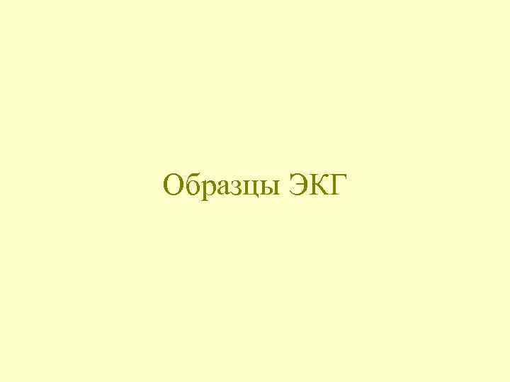 Образцы ЭКГ 