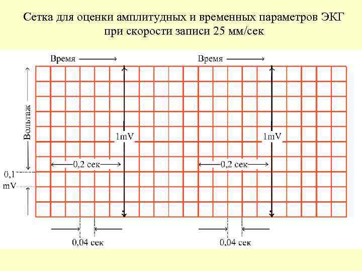 Сетка для оценки амплитудных и временных параметров ЭКГ при скорости записи 25 мм/сек 