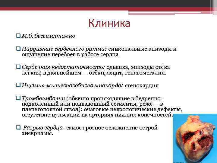 Клиника q М. б. бессимптомно q Нарушение сердечного ритма: синкопальные эпизоды и ощущение перебоев