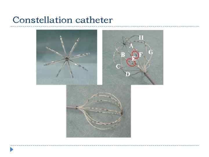 Constellation catheter 