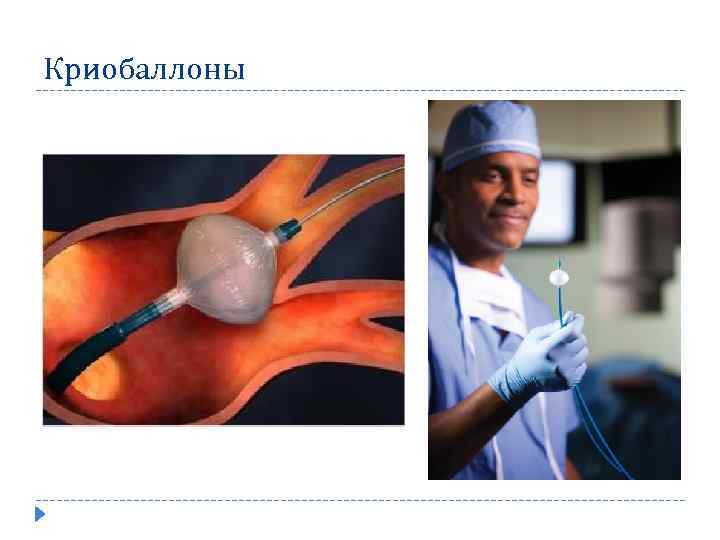 Криобаллоны 