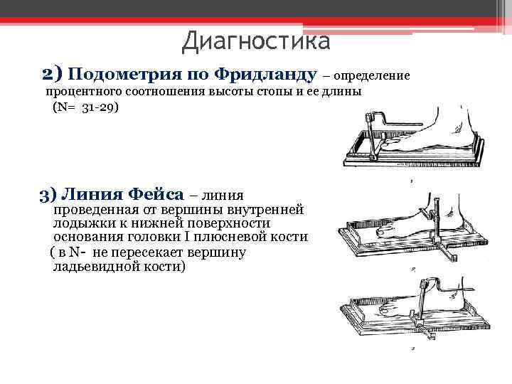 Диагностика 2) Подометрия по Фридланду – определение процентного соотношения высоты стопы и ее длины