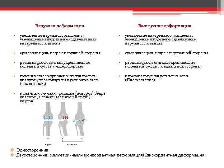 Вальгусная деформация Варусная деформация • увеличение наружного мыщелка, уменьшение внутреннего -сдавливанию внутреннего мениска •