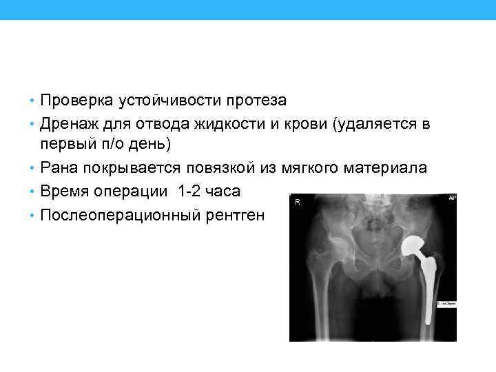  • Проверка устойчивости протеза • Дренаж для отвода жидкости и крови (удаляется в