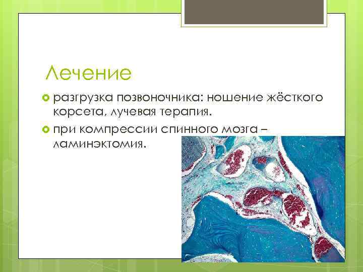 Лечение разгрузка позвоночника: ношение жёсткого корсета, лучевая терапия. при компрессии спинного мозга – ламинэктомия.
