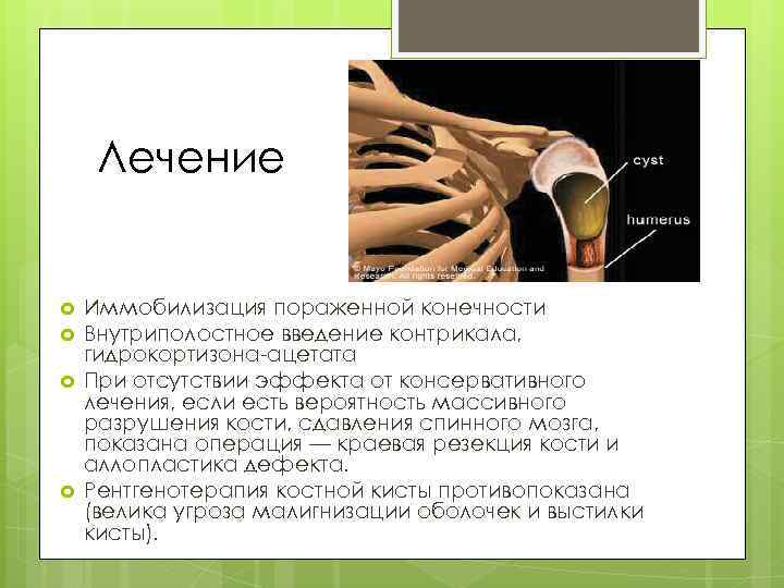Лечение Иммобилизация пораженной конечности Внутриполостное введение контрикала, гидрокортизона-ацетата При отсутствии эффекта от консервативного лечения,