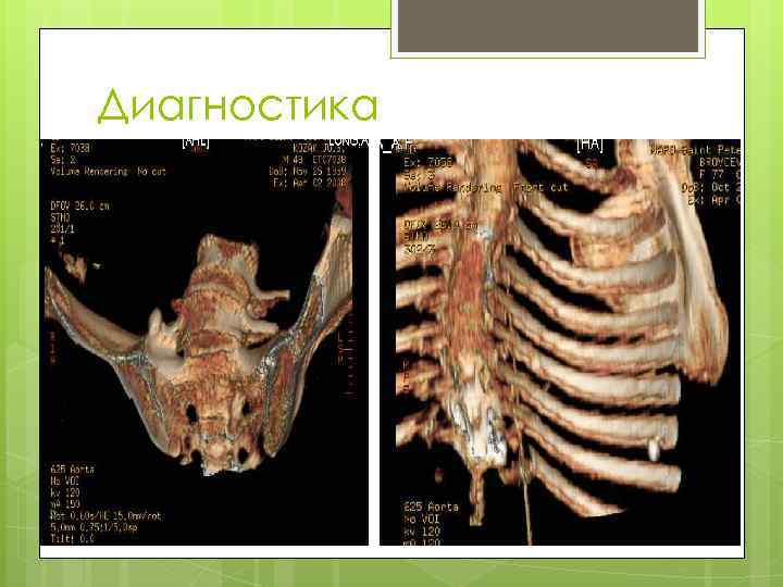 Диагностика 